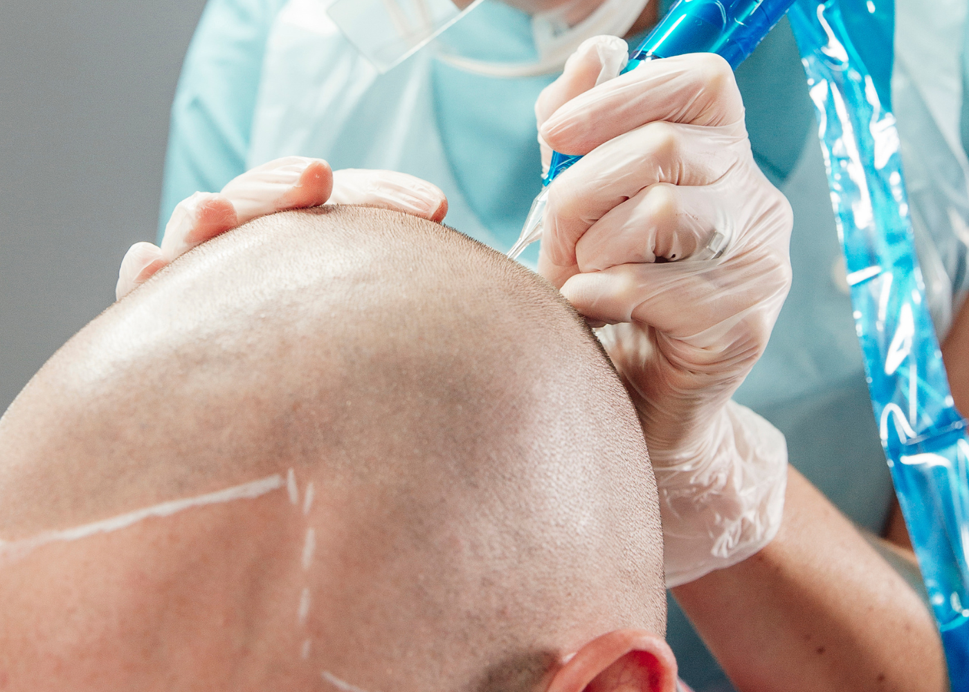 Männerkopf während der Haarpigmentierung im Studio Slawa Savin